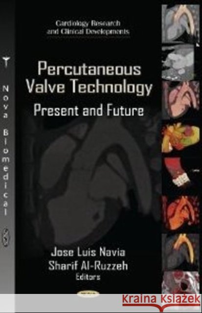Percutaneous Valve Technology: Present & Future Jose Navia, Sharif Al-Ruzzeh 9781619425774