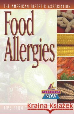 Food Allergies: The Nutrition Now Series The American Dietetic Association 9781620456606 John Wiley & Sons