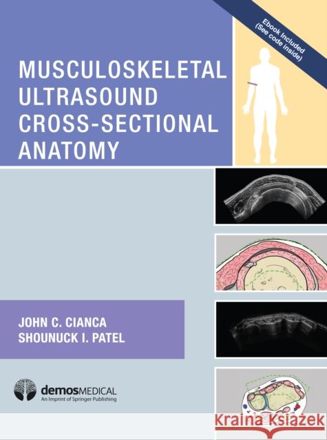 Musculoskeletal Ultrasound Cross-Sectional Anatomy John Cianca 9781620700624 Demos Medical Publishing