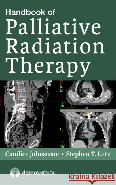 Handbook of Palliative Radiation Therapy Candice Johnstone Stephen Lutz 9781620700952