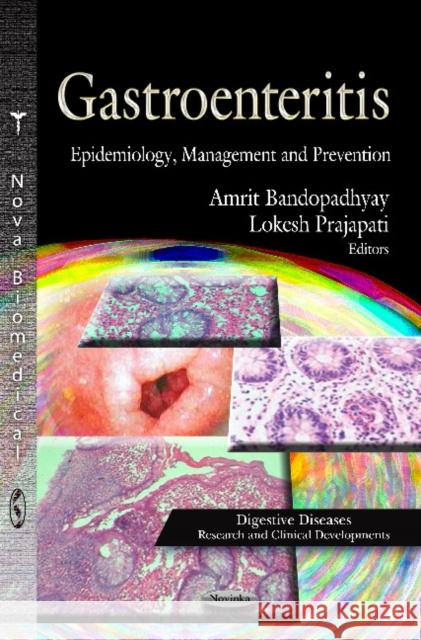 Gastroenteritis: Epidemiology, Management & Prevention Amrit Bandopadhyay, Lokesh Prajapati 9781620818152 Nova Science Publishers Inc