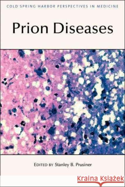 Prion Diseases Stanley B. Prusiner Stanley B. Prusiner 9781621820109 Cold Spring Harbor Laboratory Press