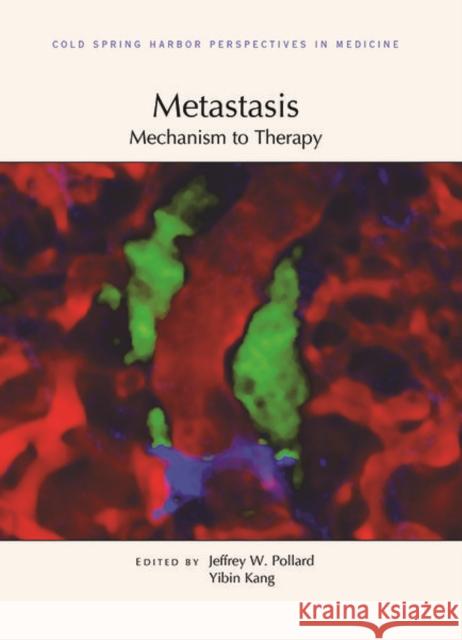 Metastasis: Mechanism to Therapy Pollard, Jeffrey W. 9781621823247 Cold Spring Harbor Laboratory Press