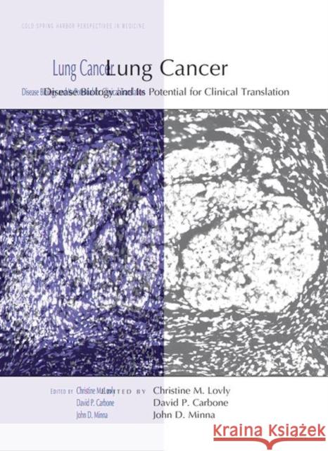 Lung Cancer: Disease Biology and Its Potential for Clinical Translation John Minna David Carbone Christine Lovly 9781621823735