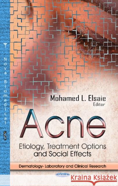 Acne: Etiology, Treatment Options & Social Effects Mohamed L Elsaie 9781626183582 Nova Science Publishers Inc
