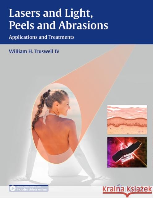 Lasers and Light, Peels and Abrasions: Applications and Treatments Truswell, William H. 9781626230019 Thieme Medical Publishers