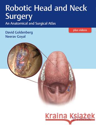 Robotic Head and Neck Surgery: An Anatomical and Surgical Atlas Goldenberg, David 9781626230033