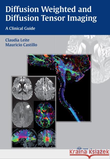 Diffusion Weighted and Diffusion Tensor Imaging: A Clinical Guide Leite, Claudia 9781626230217 Thieme Medical Publishers