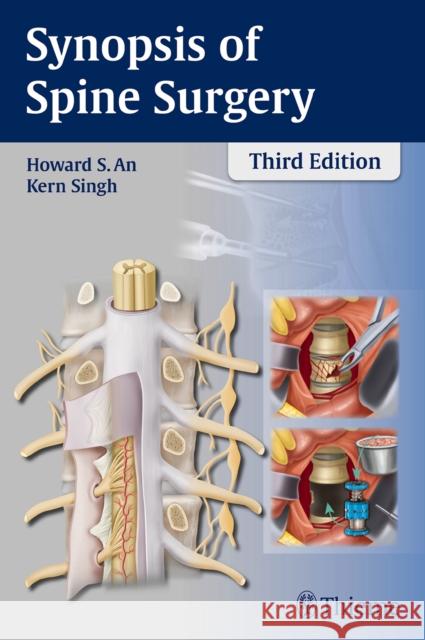 Synopsis of Spine Surgery Howard S. An Kern Singh 9781626230309 Thieme Medical Publishers