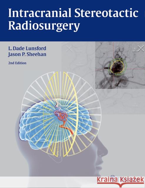 Intracranial Stereotactic Radiosurgery L. Dade Lunsford Jason P. Sheehan 9781626230323 Thieme Medical Publishers