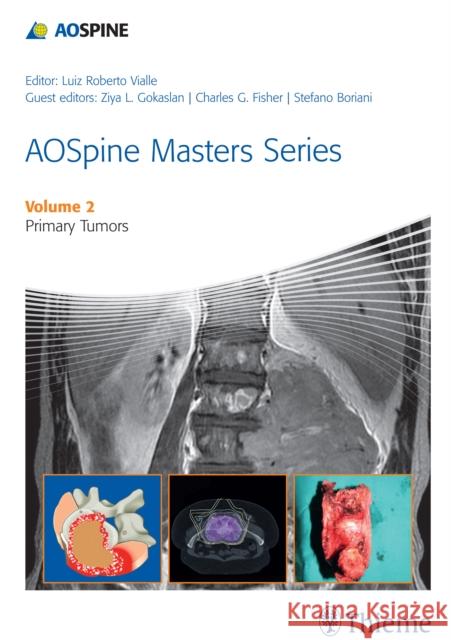 Aospine Masters Series Volume 2: Primary Spinal Tumors Vialle, Luiz Roberto Gomes 9781626230477 Thieme Medical Publishers