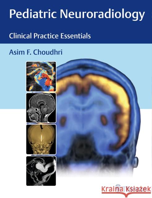 Pediatric Neuroradiology: Clinical Practice Essentials Choudhri, Asim F. 9781626230965 Thieme Medical Publishers