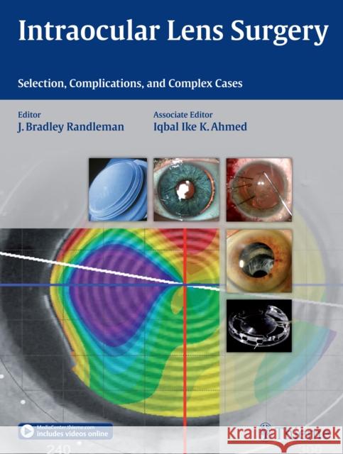 Intraocular Lens Surgery: Selection, Complications, and Complex Cases Randleman, Bradley 9781626231146 Thieme Medical Publishers