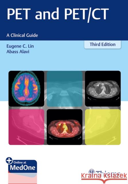 Pet and Pet/CT: A Clinical Guide Lin, Eugene C. 9781626231344 Thieme Medical Publishers