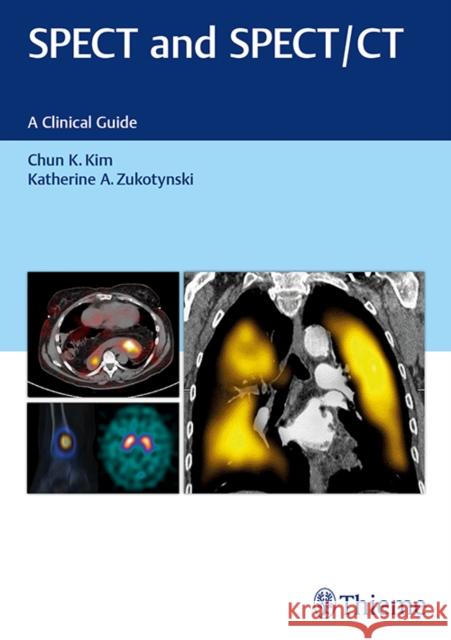 Spect and Spect/CT: A Clinical Guide Kim, Chun 9781626231511 Thieme Medical Publishers