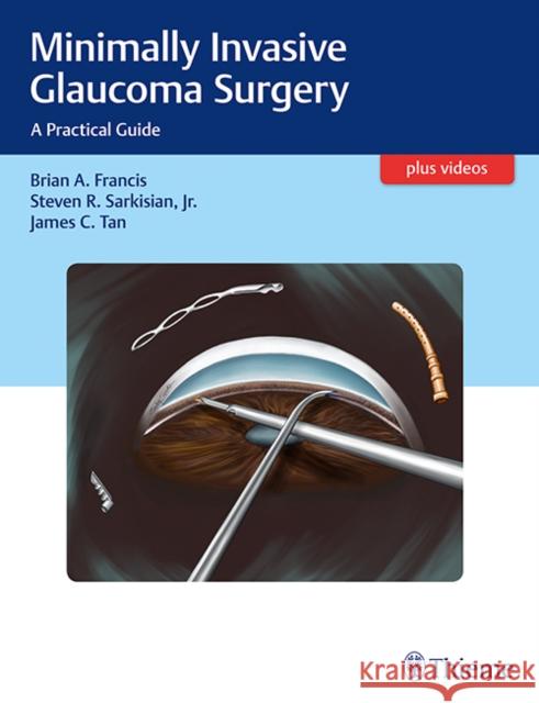 Minimally Invasive Glaucoma Surgery: A Practical Guide Francis, Brian 9781626231566