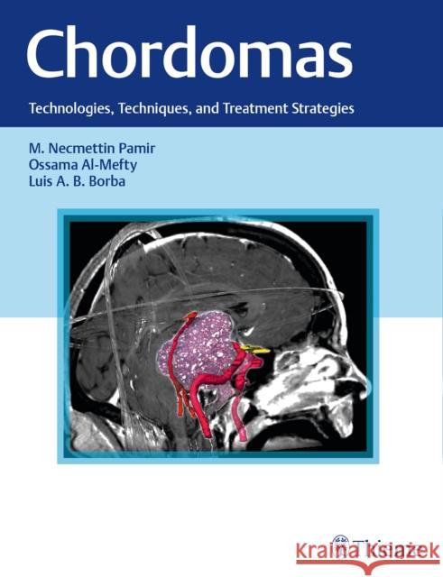 Chordomas: Technologies, Techniques, and Treatment Strategies Pamir, M. Necmettin 9781626231597 Thieme Medical Publishers