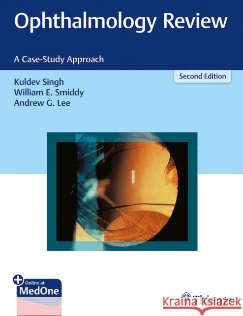 Ophthalmology Review: A Case-Study Approach Singh, Kuldev 9781626231764 Thieme Medical Publishers