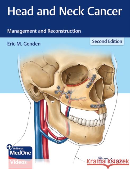 Head and Neck Cancer: Management and Reconstruction Genden, Eric M. 9781626232310 Thieme Medical Publishers