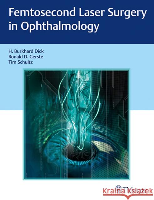 Femtosecond Laser Surgery in Ophthalmology H. B. Dick Ronald D. Gerste Tim Schulz 9781626232365 Thieme Medical Publishers