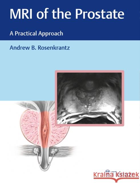 MRI of the Prostate: A Practical Approach Rosenkrantz, Andrew 9781626232686