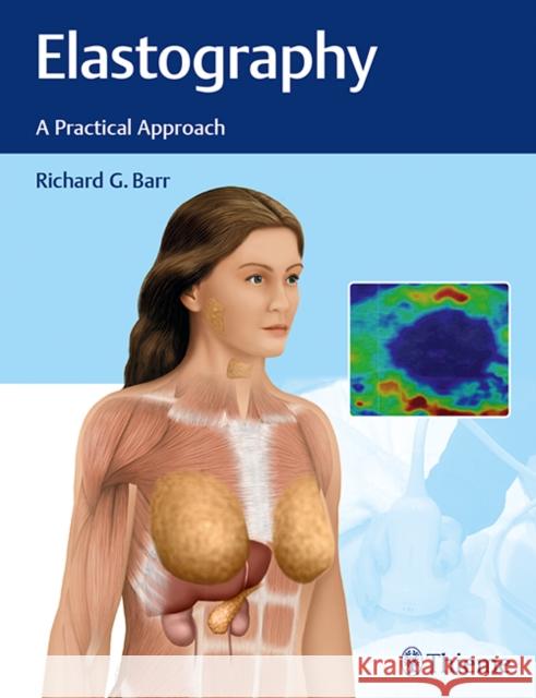 Elastography: A Practical Approach Barr, Richard G. 9781626232716 Thieme Medical Publishers