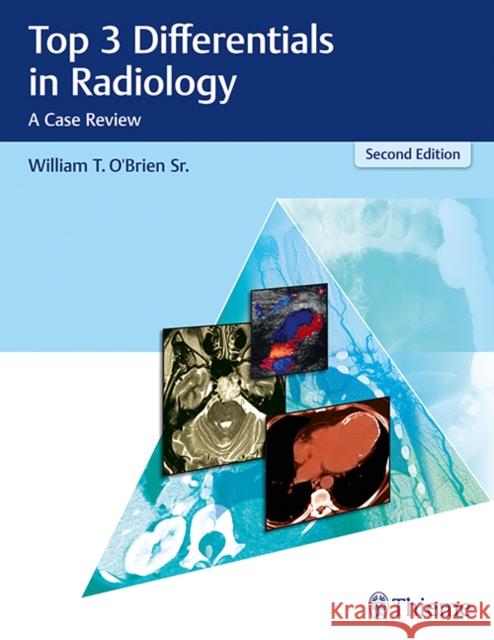 Top 3 Differentials in Radiology: A Case Review William T. O'Brien 9781626232785 Thieme Medical Publishers Inc