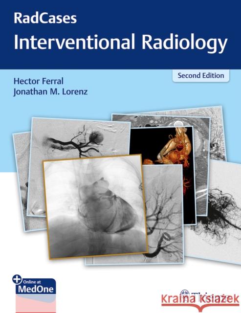 Radcases Q&A Interventional Radiology Ferral, Hector 9781626232822 Thieme Medical Publishers