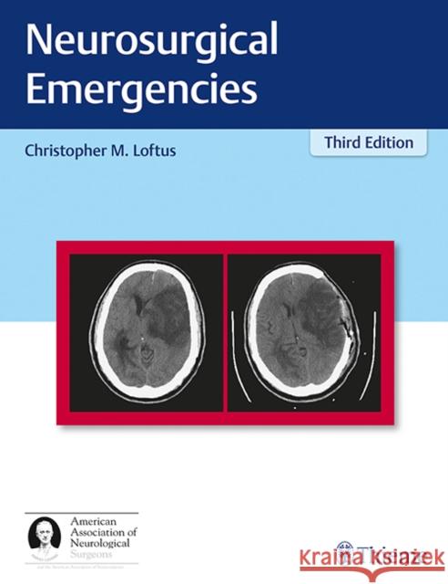 Neurosurgical Emergencies Christopher Loftus 9781626233331