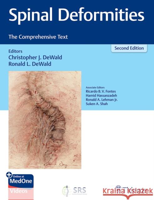 Spinal Deformities: The Comprehensive Text DeWald, Christopher 9781626233720 Thieme Medical Publishers Inc