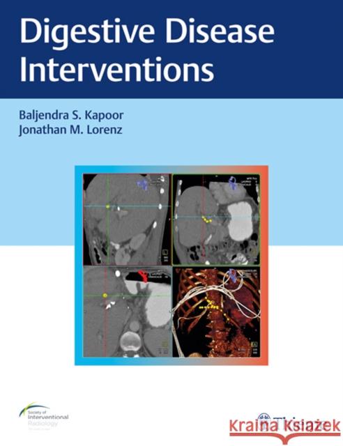 Digestive Disease Interventions Baljendra S. Kapoor Jonathan Lorenz 9781626233744 Thieme Medical Publishers