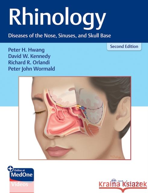 Rhinology: Diseases of the Nose, Sinuses, and Skull Base  9781626233768 Thieme Medical Publishers Inc