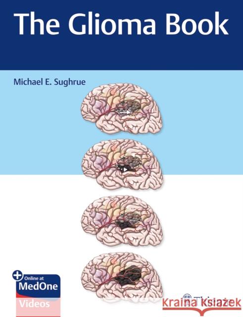 The Glioma Book Sughrue, Michael E. 9781626234444 Thieme Medical Publishers