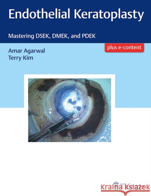 Endothelial Keratoplasty: Mastering Dsek, Dmek, and Pdek Agarwal, Amar 9781626234512 Thieme Medical Publishers