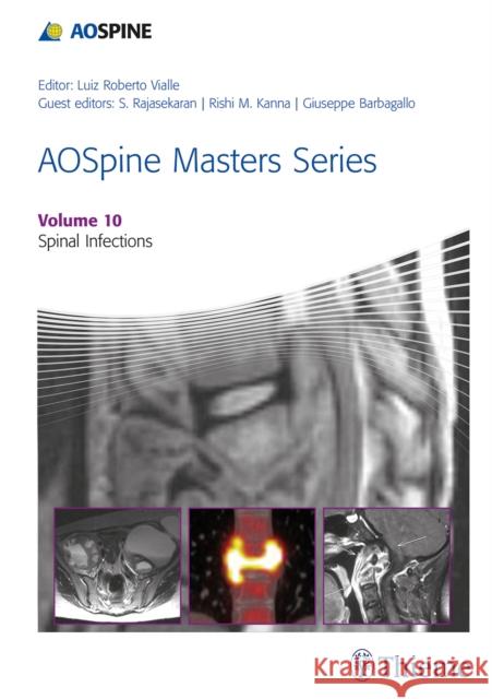 Aospine Masters Series, Volume 10: Spinal Infections Rajasekaran, Shanmuganathan 9781626234550 Thieme Medical Publishers