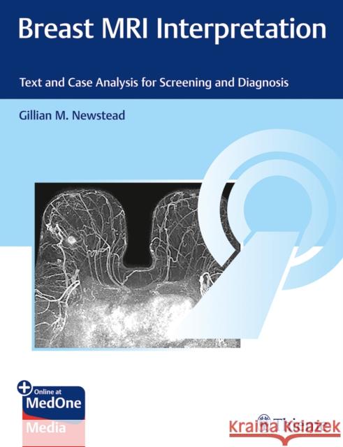 Breast MRI Interpretation: Text and Case Analysis for Screening and Diagnosis Gillian M. Newstead 9781626234673 Thieme Medical Publishers