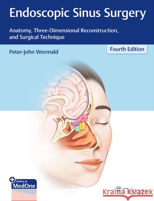 Endoscopic Sinus Surgery: Anatomy, Three-Dimensional Reconstruction, and Surgical Technique Wormald, Peter J. 9781626234697 Thieme Medical Publishers