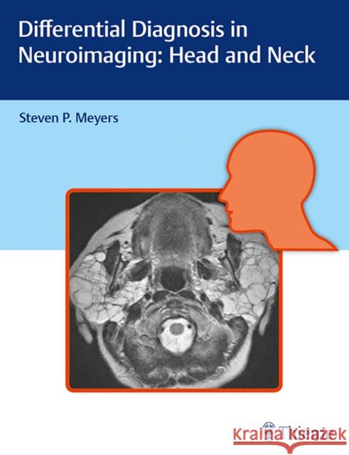 Differential Diagnosis in Neuroimaging: Head and Neck Meyers, Steven 9781626234758