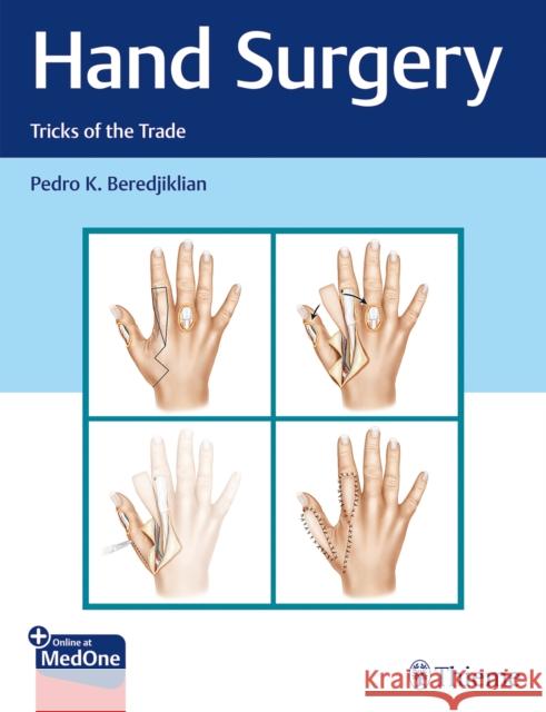 Hand Surgery: Tricks of the Trade Beredjiklian, Pedro 9781626234796 Thieme Medical Publishers