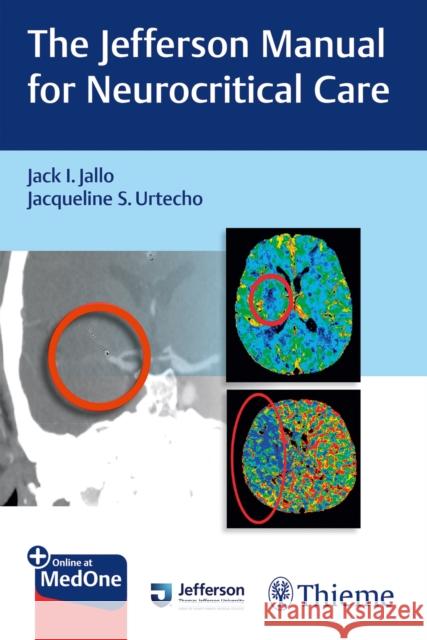 The Jefferson Manual for Neurocritical Care Jack I. Jallo Jacqueline Urtecho 9781626234949