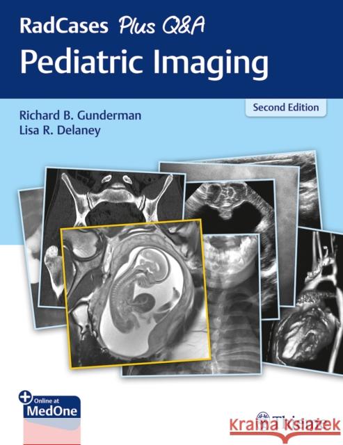 Radcases Plus Q&A Pediatric Imaging Gunderman, Richard B. 9781626235199 Thieme Medical Publishers