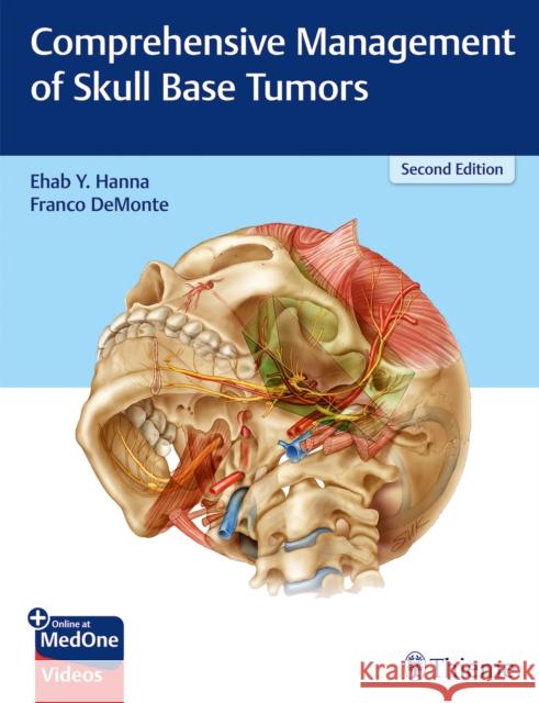 Comprehensive Management of Skull Base Tumors Hanna, Ehab Y. 9781626235328 Thieme Medical Publishers