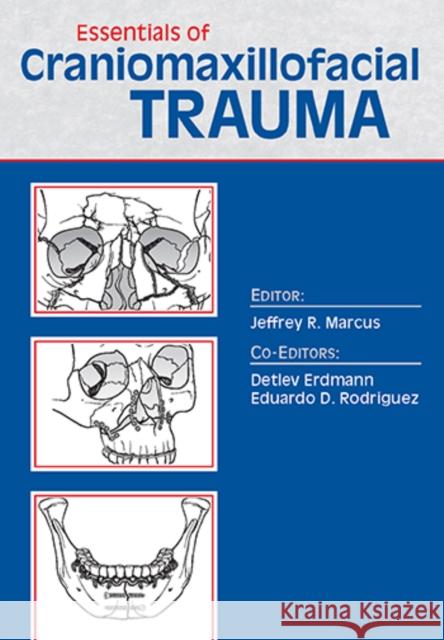 Essentials of Craniomaxillofacial Trauma Jeffrey Marcus   9781626235595 Thieme Medical Publishers Inc