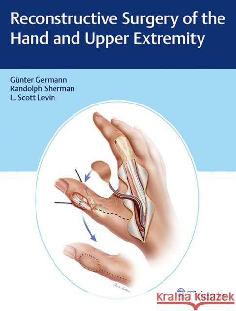 Reconstructive Surgery of the Hand and Upper Extremity Germann, Günter 9781626236011