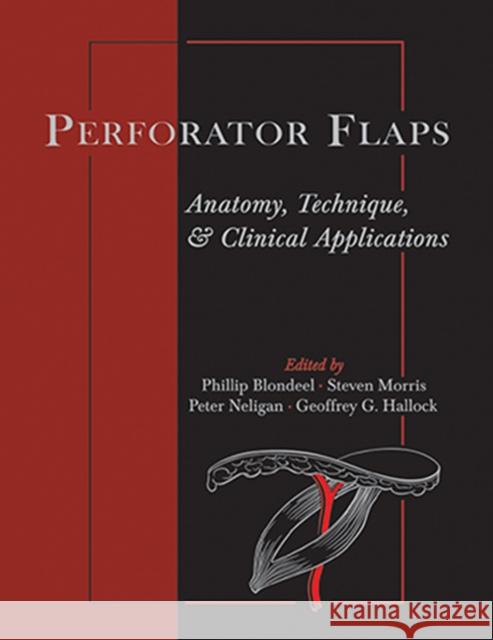 Perforator Flaps: Anatomy, Technique, & Clinical Applications Blondeel, Phillip N. 9781626236097 Thieme Medical Publishers Inc