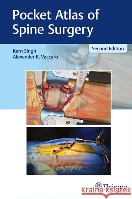 Pocket Atlas of Spine Surgery Kern Singh Alexander R. Vaccaro 9781626236233 Thieme Medical Publishers