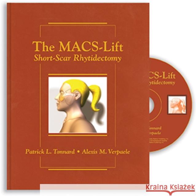 The Macs-Lift: Short-Scar Rhytidectomy Tonnard, Patrick 9781626236332 Thieme Medical Publishers Inc