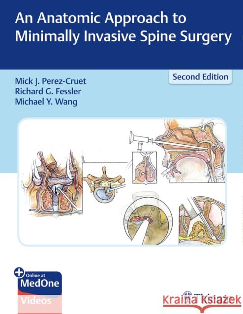 An Anatomic Approach to Minimally Invasive Spine Surgery Perez-Cruet, Miguelangelo 9781626236431 Thieme Medical Publishers