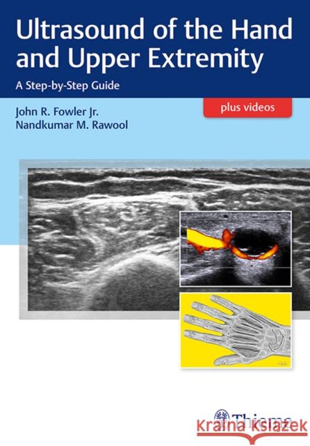 Ultrasound of the Hand and Upper Extremity: A Step-By-Step Guide Fowler, John R. 9781626236882 Thieme Medical Publishers