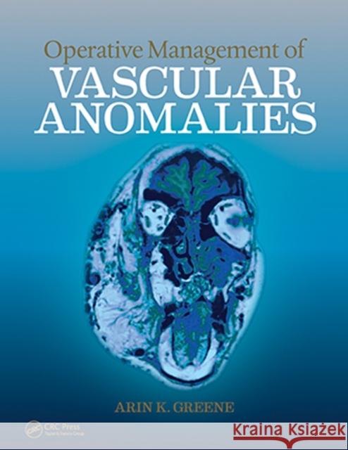 Operative Management of Vascular Anomalies Arin K. Greene 9781626236905 Thieme Medical Publishers